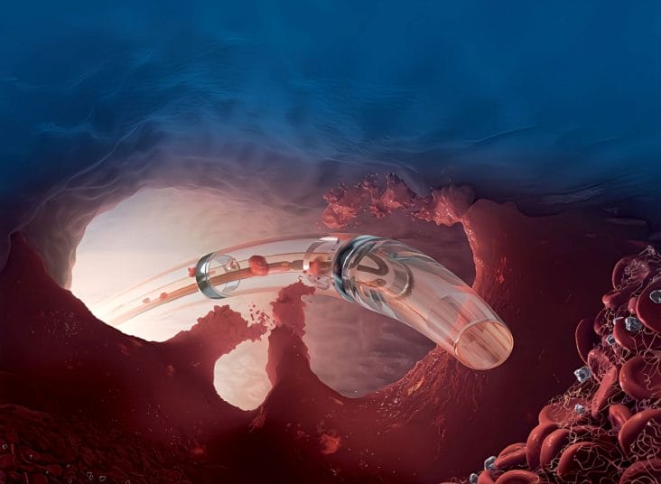 media-173736805591679600.jpg - Știri de azi Știri de azi | Se simțea foarte obosit și respira greu. Ce a descoperit un bărbat - Știri de azi |