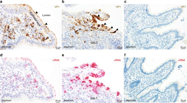 Știri de azi | ‘Ferrari-ul virușilor’ stabilește un record de infectări în emisfera nordică - Știri de azi | 