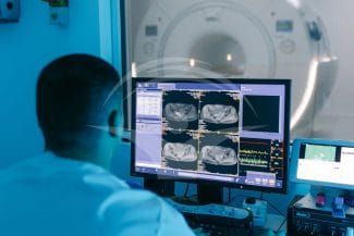 media-173982454579026000.jpg - Știri de azi Știri de azi | Descoperire revoluționară: RMN-ul ultra-puternic detectează „ascunzătorile” epilepsiei și deschide calea spre vindecare chirurgicală! - Știri de azi |