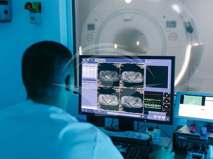 Știri de azi | Descoperire revoluționară: RMN-ul ultra-puternic detectează „ascunzătorile” epilepsiei și deschide calea spre vindecare chirurgicală! - Știri de azi | 