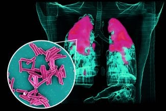Știri de azi | OMS trage un semnal de alarmă! Creștere alarmantă a cazurilor de tuberculoză infantilă – Ce arată raportul - Știri de azi | 