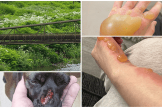 media-175121032400756600png - Știri de azi Știri de azi | Planta care arde ca acidul invadează România: Seamănă cu banalul pătrunjel, dar provoacă arsuri și bășici cât mingile de golf - Știri de azi |