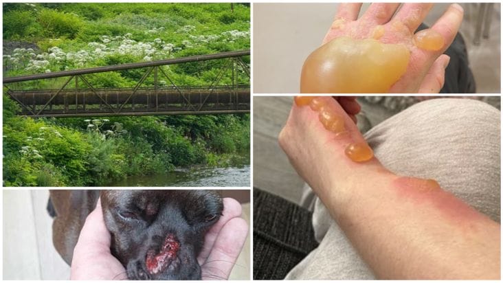 media-175121032400756600png - Știri de azi Știri de azi | Planta care arde ca acidul invadează România: Seamănă cu banalul pătrunjel, dar provoacă arsuri și bășici cât mingile de golf - Știri de azi |