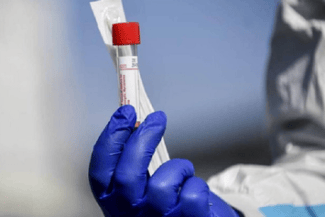 coro-tw2png - Știri de azi Știri de azi | Studiu revoluţionar la Stanford: un test de sânge poate estima vârsta biologică a organelor umane - Știri de azi |