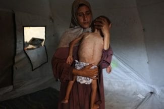 Știri de azi | Un sfert dintre copii de până la cinci ani şi femei însărcinate şi care alăptează, examinaţi de MSF în Fâşia Gaza în ultimele două săptămâni, suferă de malnutriţie. MSF denunţă ”o foamete deliberată, provocată de către autorităţile israeliene în campania - Știri de azi | 