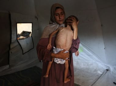 gaza-malnutritie-tw5jpg - Știri de azi Știri de azi | Un sfert dintre copii de până la cinci ani şi femei însărcinate şi care alăptează, examinaţi de MSF în Fâşia Gaza în ultimele două săptămâni, suferă de malnutriţie. MSF denunţă ”o foamete deliberată, provocată de către autorităţile israeliene în campania - Știri de azi |