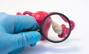 media-169952732937064300jpg - Știri de azi Știri de azi | Un test revoluționar detectează endometrioza în 10 minute - Știri de azi |