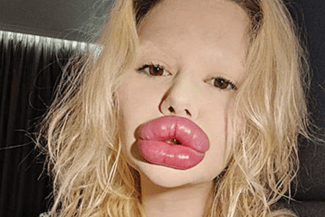 Știri de azi | ‘M-am simţit groaznic’: de ce medicii stomatologi refuză să o trateze pe această femeie - Știri de azi | 