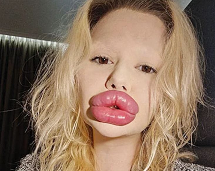 media-175246064917240600png - Știri de azi Știri de azi | ‘M-am simţit groaznic’: de ce medicii stomatologi refuză să o trateze pe această femeie - Știri de azi |