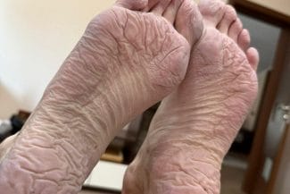 Știri de azi | FOTO – Polițiști abuzați la căutările fugarului Gânj? Sindicat: ‘Picioarele unui polițist după 31 de ore pe teren’ - Știri de azi | 