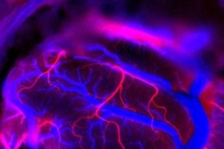 Știri de azi | Neuralink, compania lui Elon Musk, va testa implanturi cerebrale pentru persoane cu tulburări de vorbire - Știri de azi | 