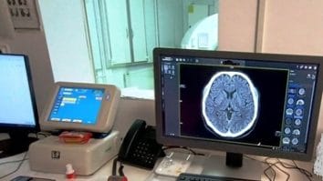 Știri de azi | Terapia cu ultrasunete ar putea creşte şansele de supravieţuire după un AVC - Știri de azi | 