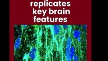 Știri de azi | Ţesuturi cerebrale create în laborator, care reproduc toate tipurile majore de celule, ar putea accelera cercetarea în terapiile neurologice - Știri de azi | 