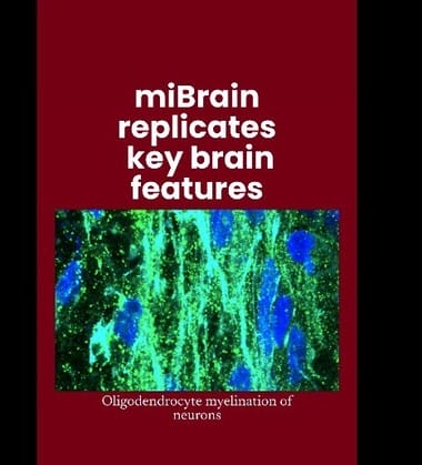 Știri de azi | Ţesuturi cerebrale create în laborator, care reproduc toate tipurile majore de celule, ar putea accelera cercetarea în terapiile neurologice - Știri de azi | 