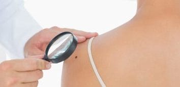 Știri de azi | O nouă clasă de medicamente ar putea schimba tratamentul cancerului agresiv de piele - Știri de azi | 