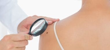 melanom-shutterstock-180004901-1200x545-cjpg - Știri de azi Știri de azi | O nouă clasă de medicamente ar putea schimba tratamentul cancerului agresiv de piele - Știri de azi |