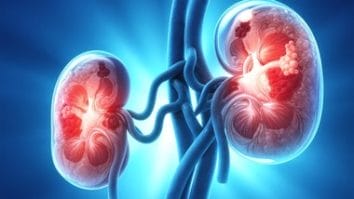 Știri de azi | Cercetătorii au identificat un mecanism molecular care poate declanşa o boală autoimună fatală - Știri de azi | 