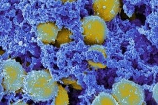 Știri de azi | Virusurile ar putea deveni o nouă armă împotriva infecţiilor bacteriene rezistente la antibiotice - Știri de azi | 