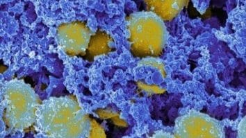 Știri de azi | Virusurile ar putea deveni o nouă armă împotriva infecţiilor bacteriene rezistente la antibiotice - Știri de azi | 